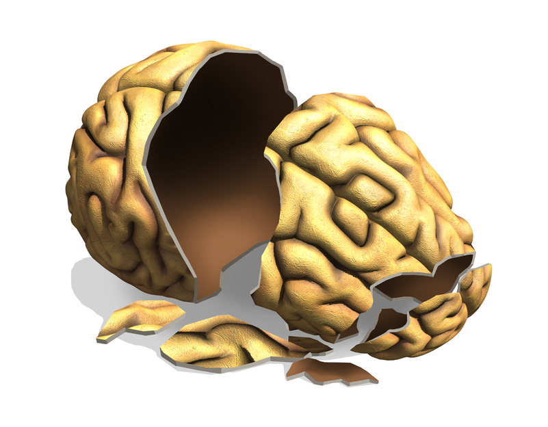 tramatic brain injury graphic